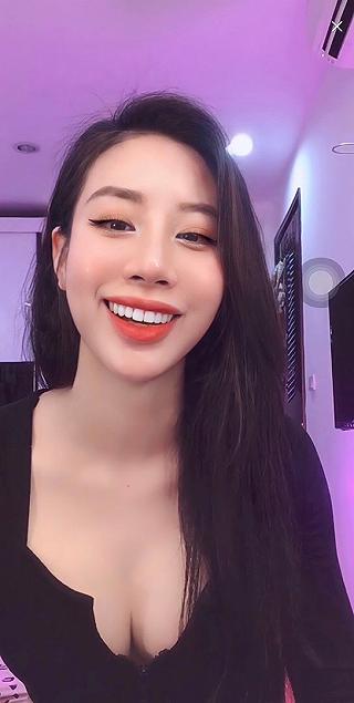 Cấy HA collagen má baby - ảnh 1 cay ha collagen ma baby - anh 1