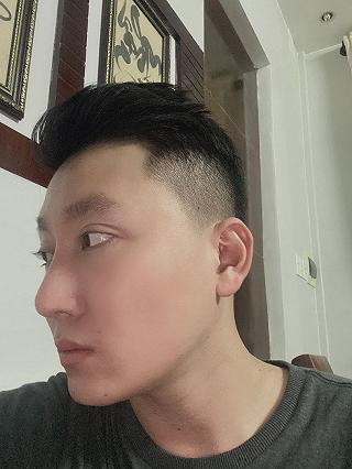 HÀNH TRÌNH TRỊ MỤN GIAN NAN VÀ ĐIỂM ĐẾN CUỐI CÙNG CỦA MÌNH !!! - ảnh 2 hanh trinh tri mun gian nan va diem den cuoi cung cua minh !!! - anh 2