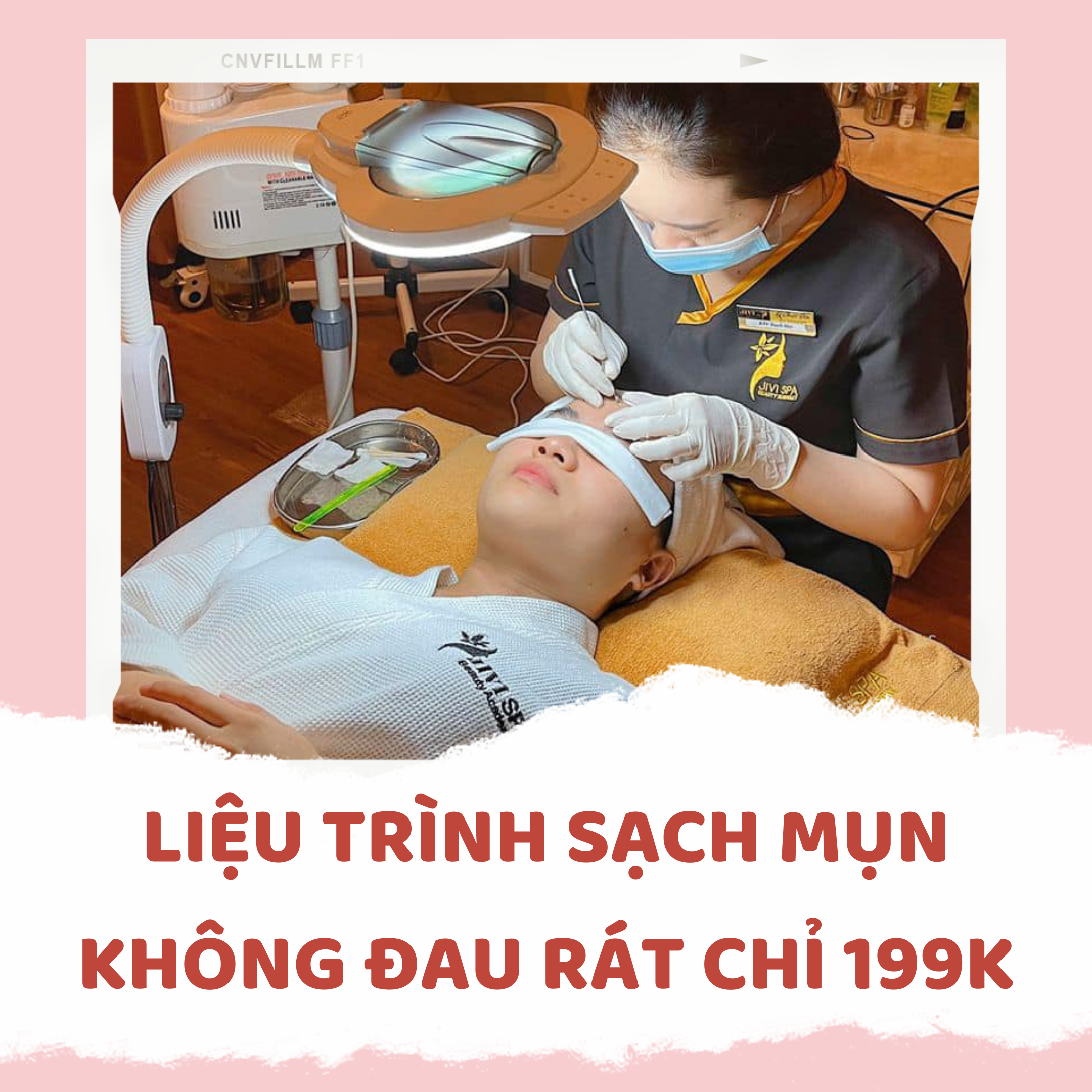 LÀM ĐẸP VỚI LIỆU TRÌNH SẠCH MỤN KO ĐAU RÁT GIÁ QUÁ HỜI CHỈ 199k 